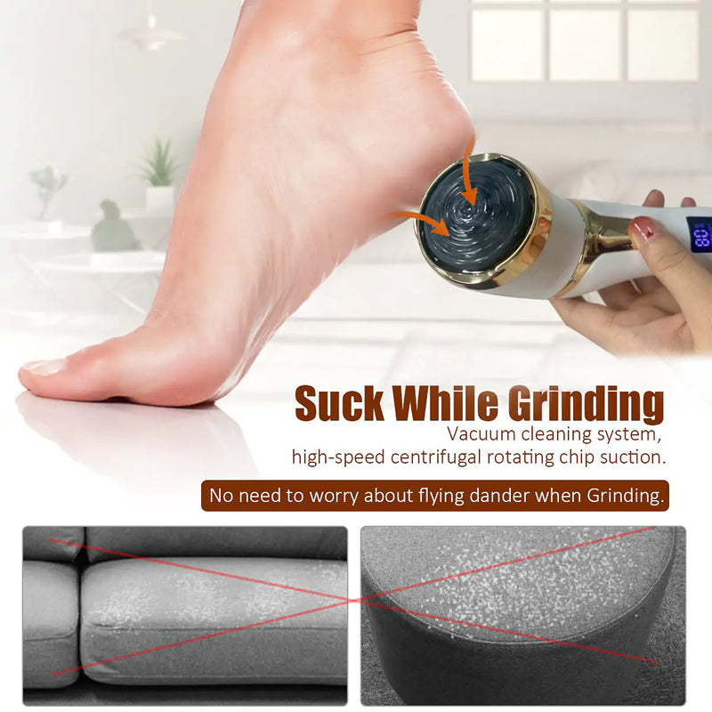 Electric Pedicure Tool - The Next Door Neighbor 