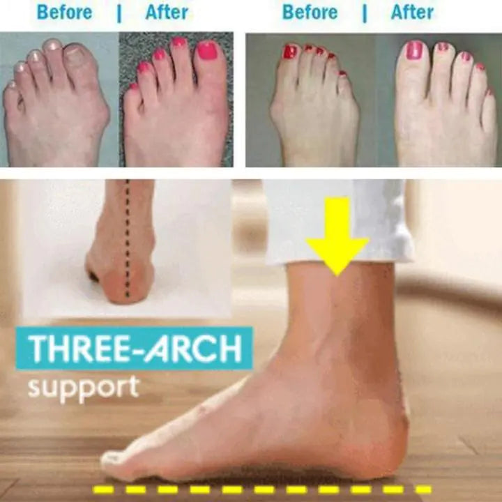 HealthySandals™ Ortho Toe Corrector Sandals - The Next Door Neighbor 