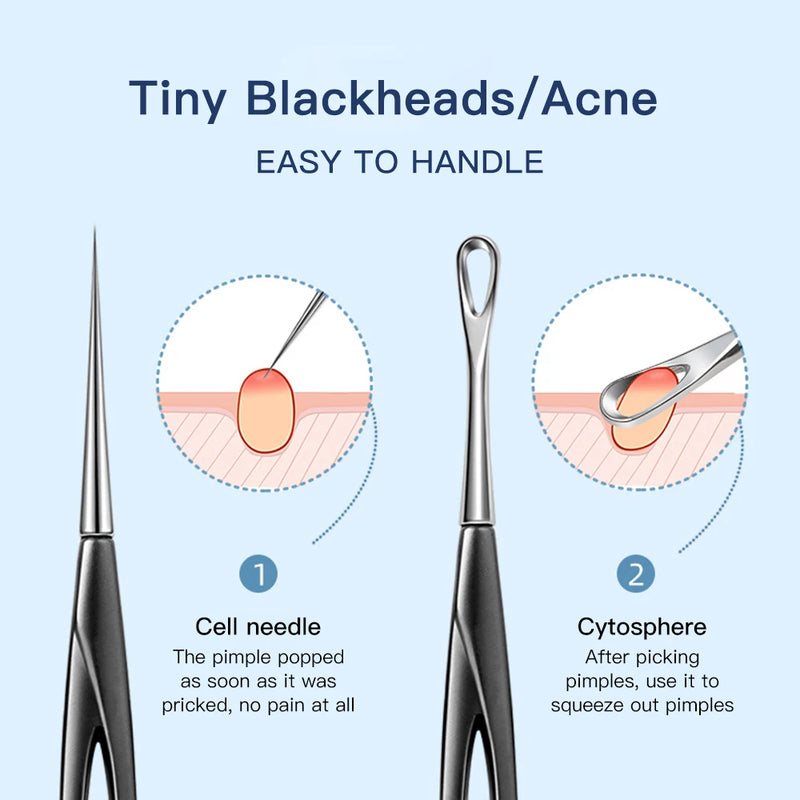 Acne Needle: Blackhead Remover Tool for Deep Skin Care & Cleansing