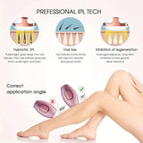 500,000 Flashes IPL Hair Removal Device