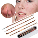 Blackhead Remover Set - The Next Door Neighbor 