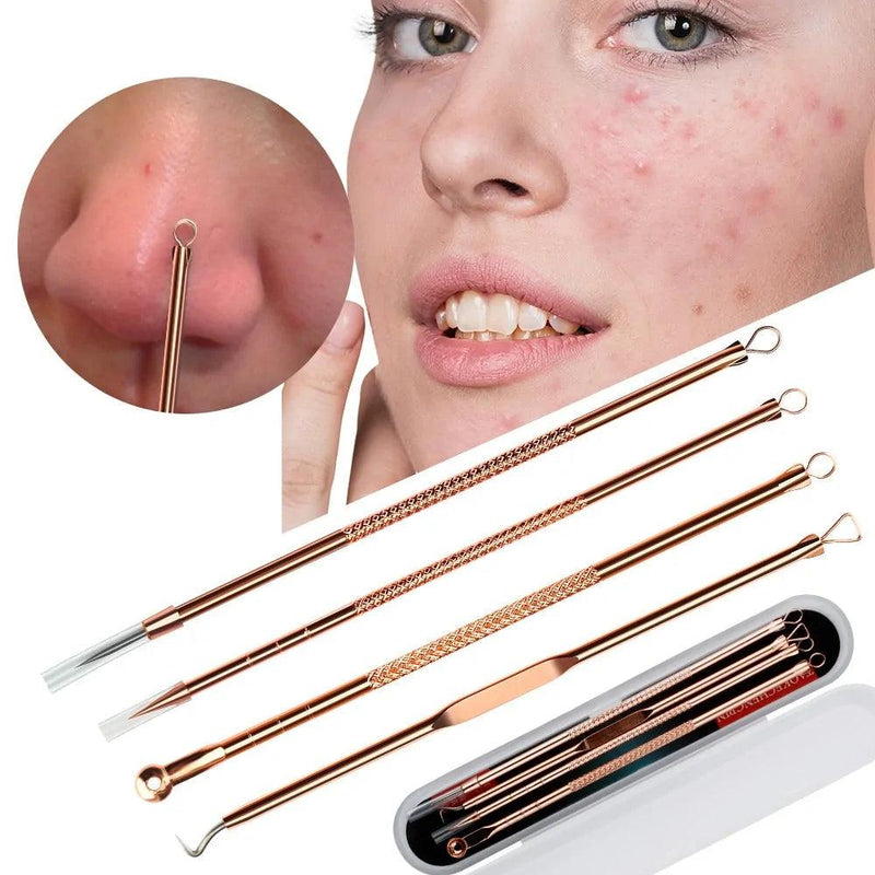 Blackhead Remover Set - The Next Door Neighbor 