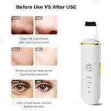 Beauty Ultrasonic Skin Scrubber - The Next Door Neighbor 